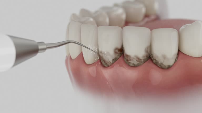 Trusted Dental Crowns And Bridges service in Concordia, MO - Dentist Open Now